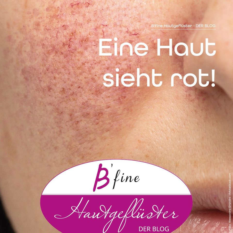 Eine Haut sieht rot. Mittel und Wege gegen Hautrötung Rote Haut - Hautrötung - Hautprobleme