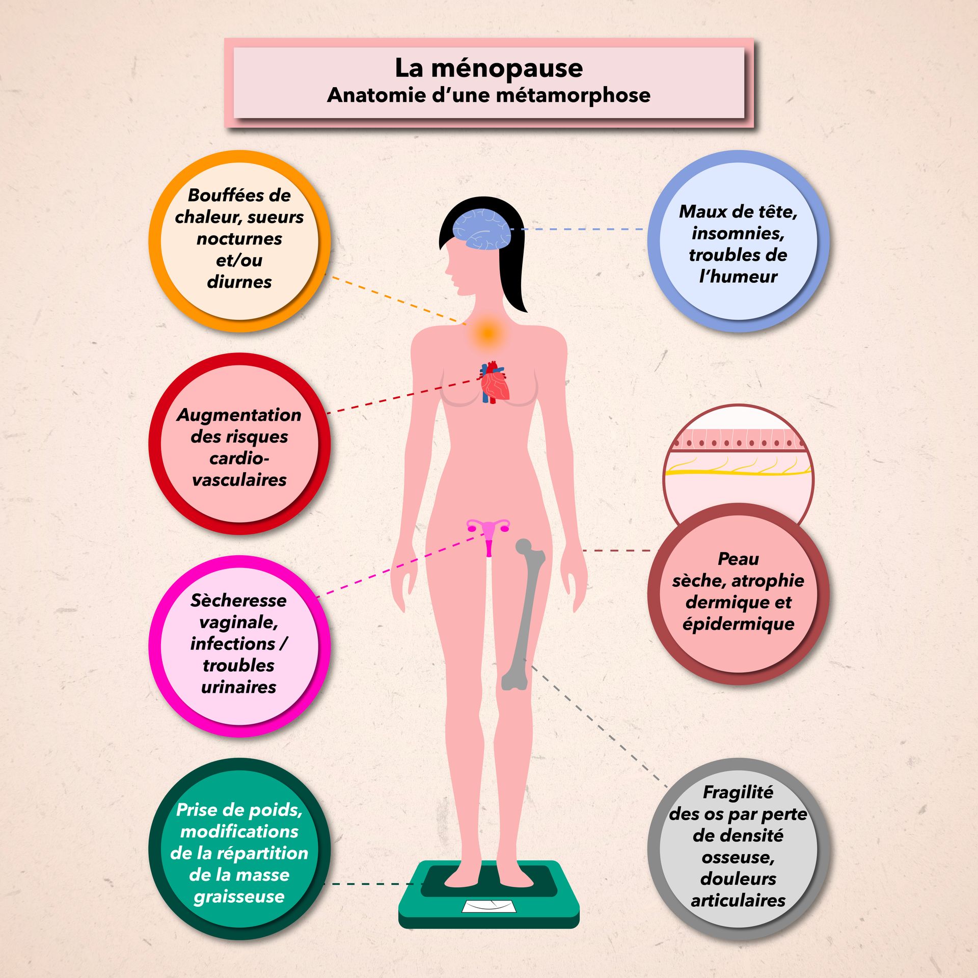 MENOPAUSE