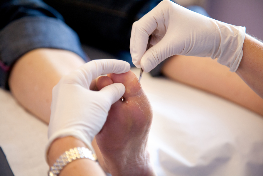 Chiropody