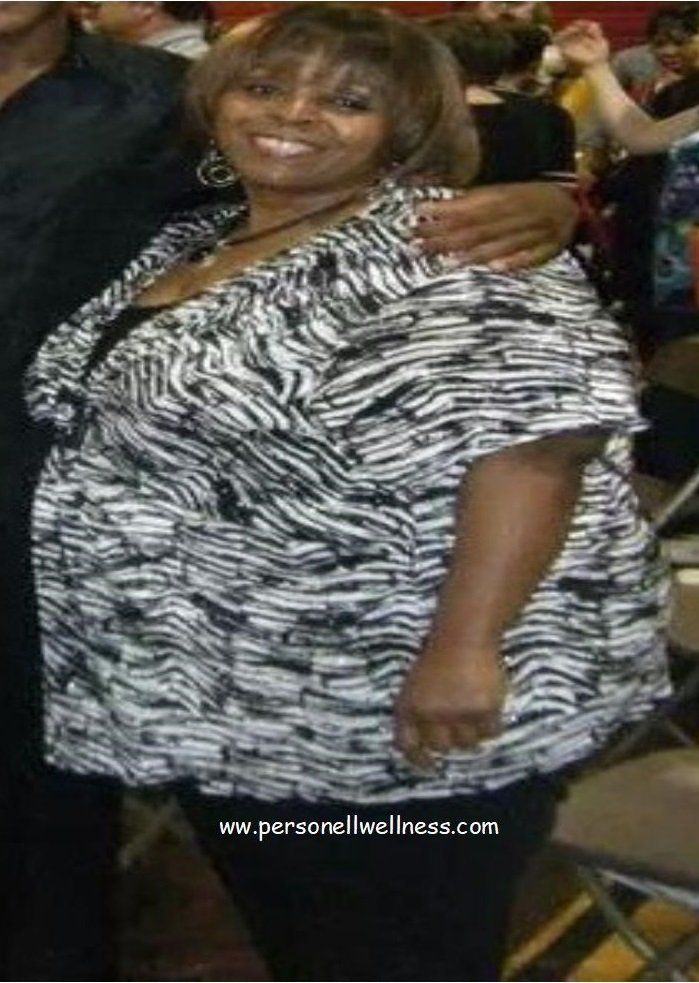 PersoNell Wellness weight loss before and after picture.