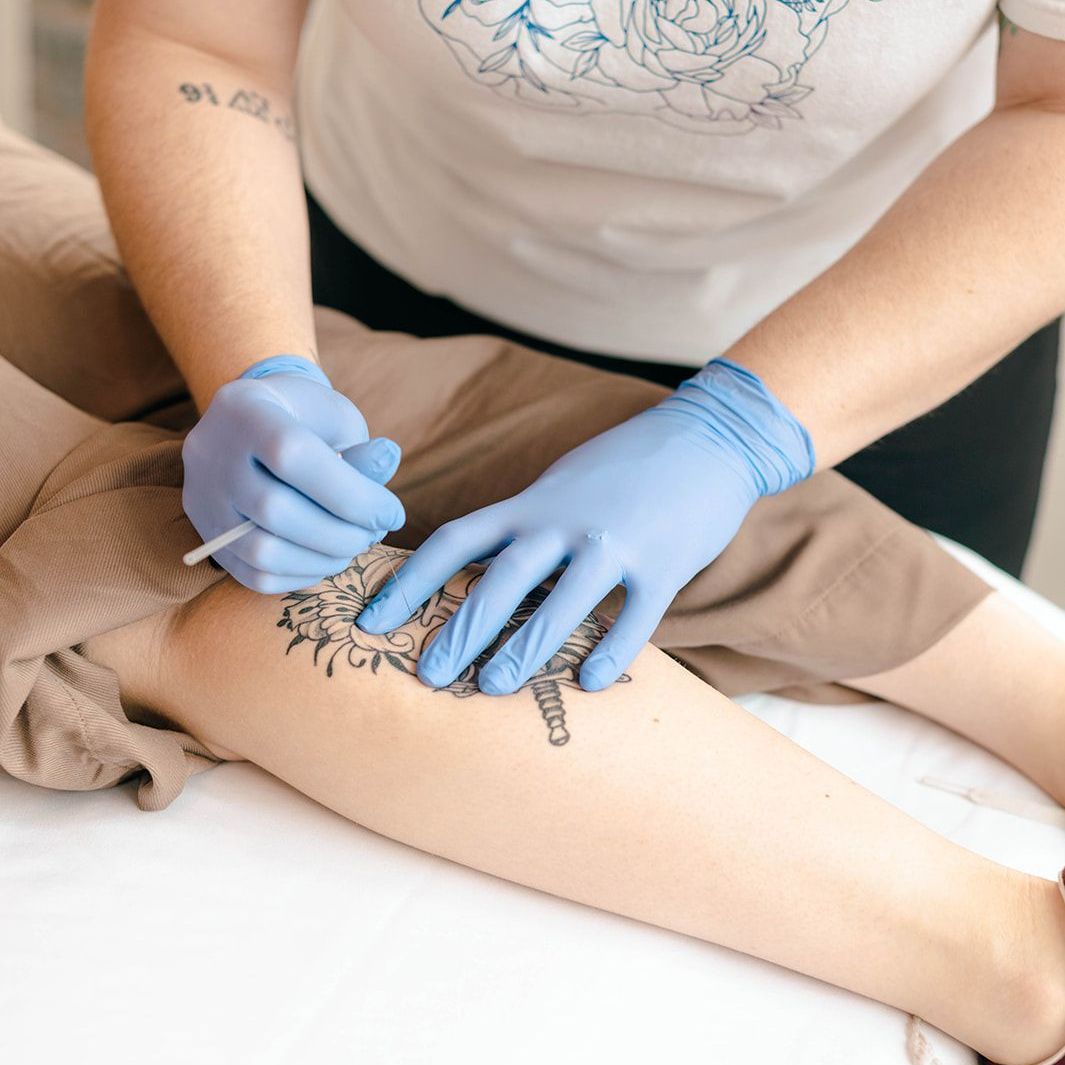 Explore the pros and cons of dry needling.