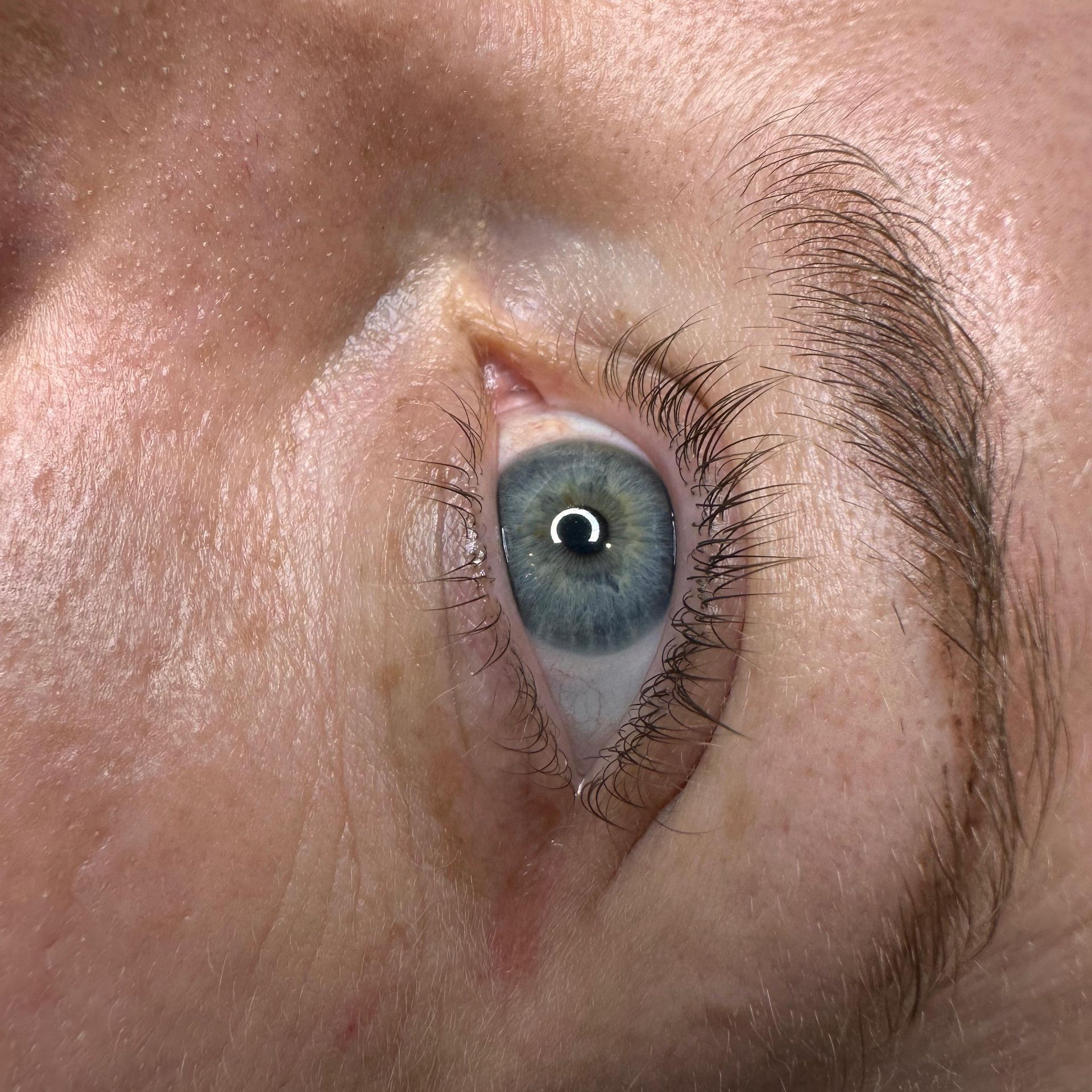 Vorher-Bild eines blauen Auges, bevor die Wimpernkranzverdichtung durchgeführt wurde.