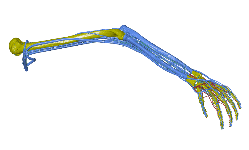 3D Scan Anantomie Modellarm