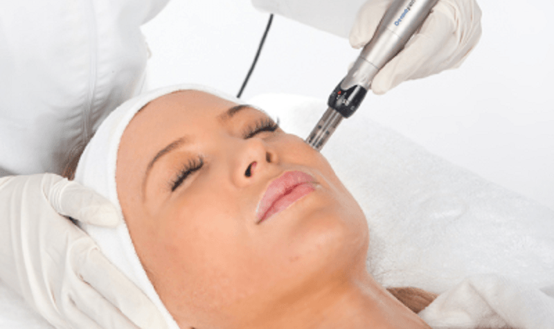 cabinet esthetique microneedling