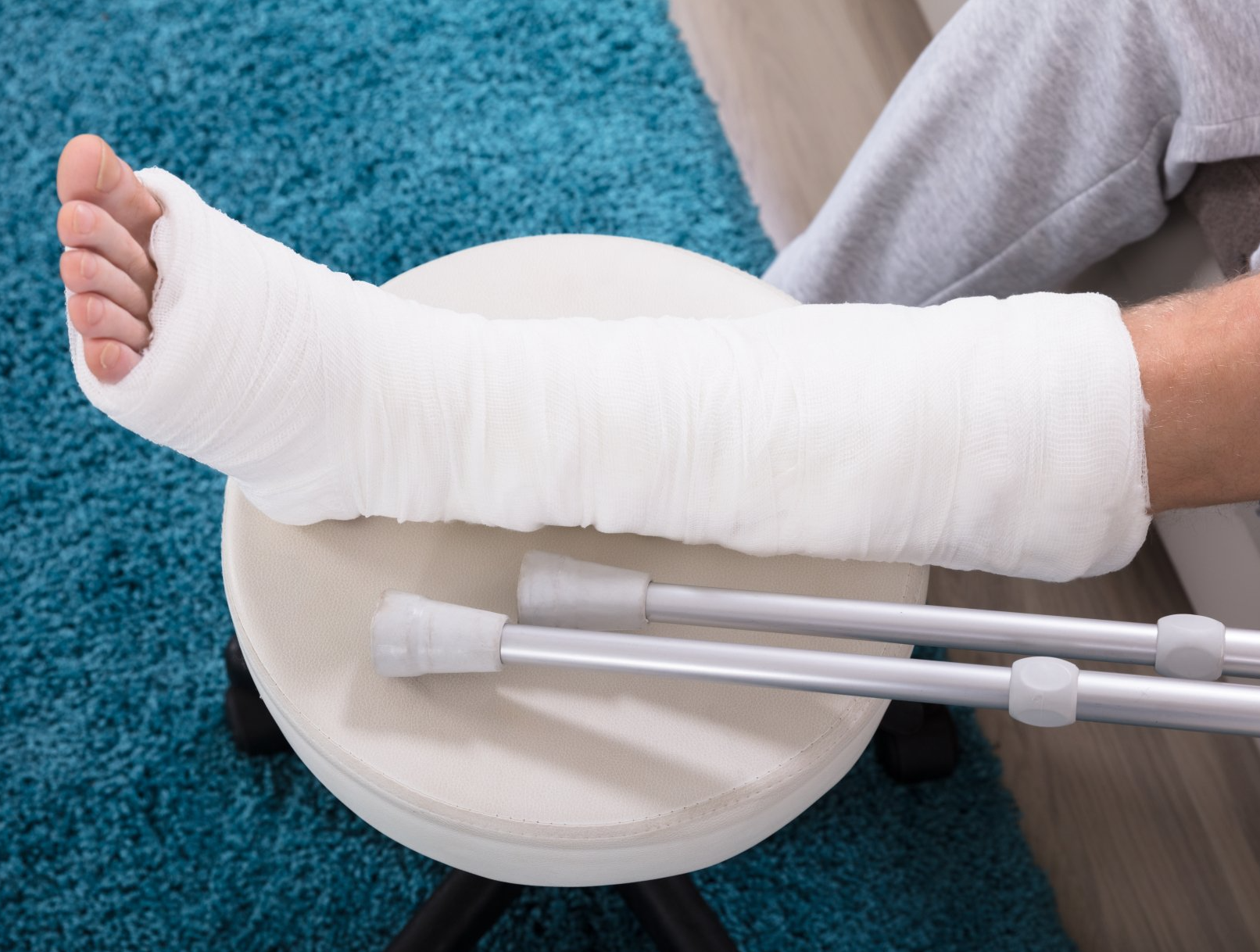 Patient with leg in plaster and crutches unable to work