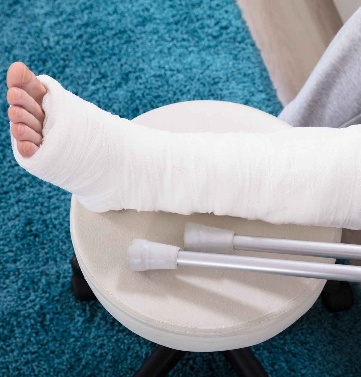 Patient unable to work with leg in plaster and crutches
