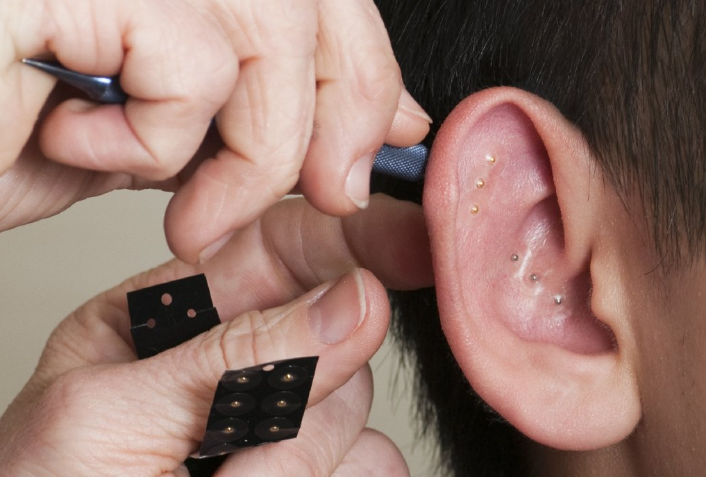 L'Auriculothérapie ou Réflexologie Auriculaire Auriculothérapie