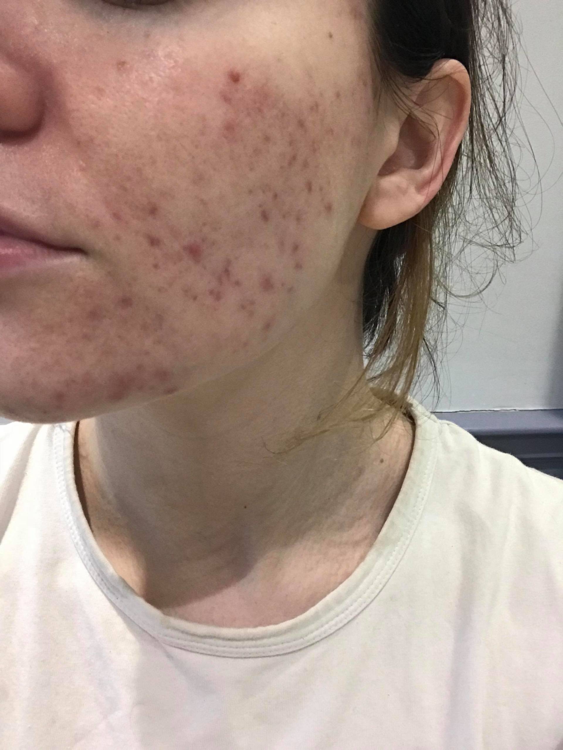 Customer Success Story Image from Beeswax Scotland