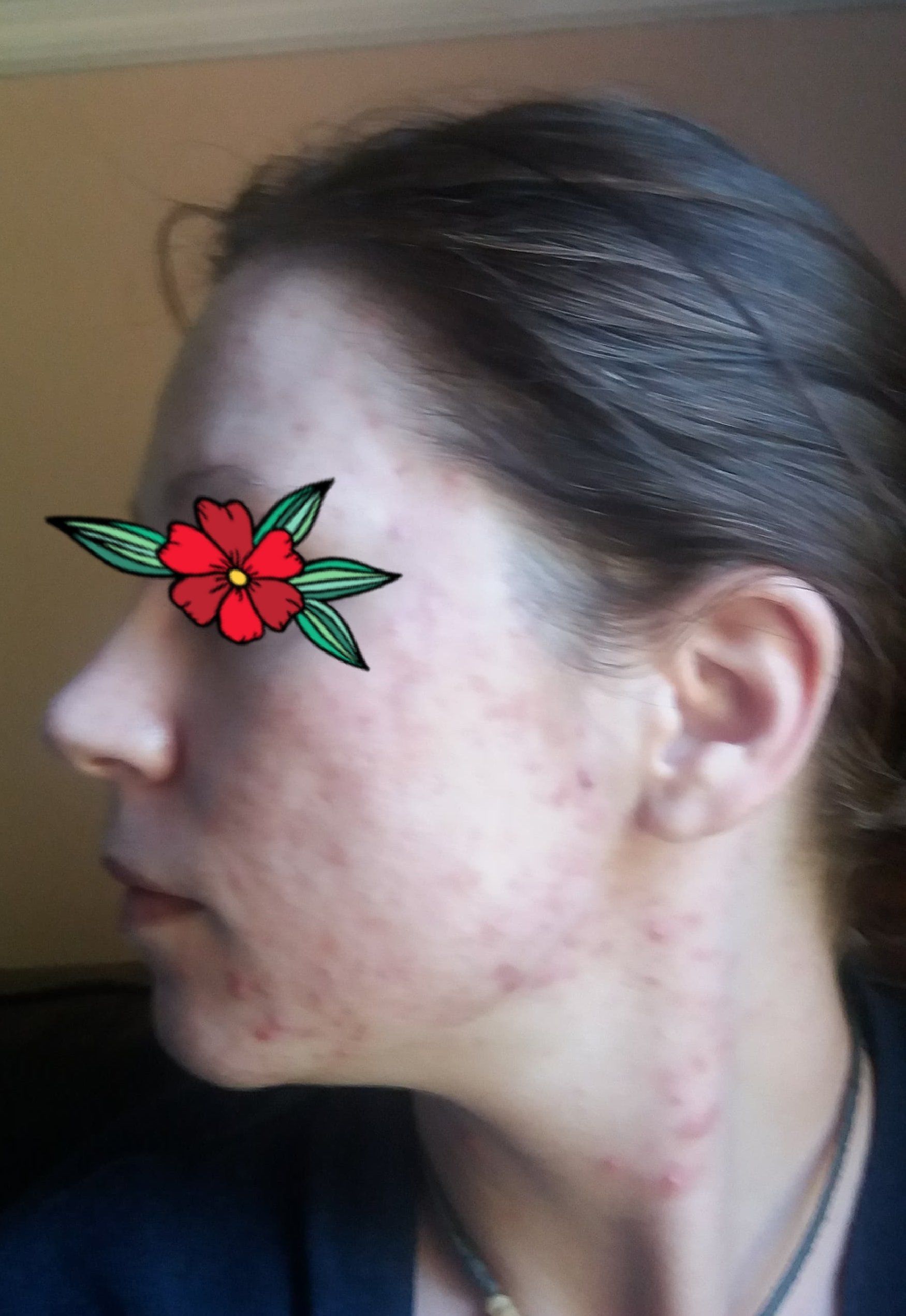 left side of face improving