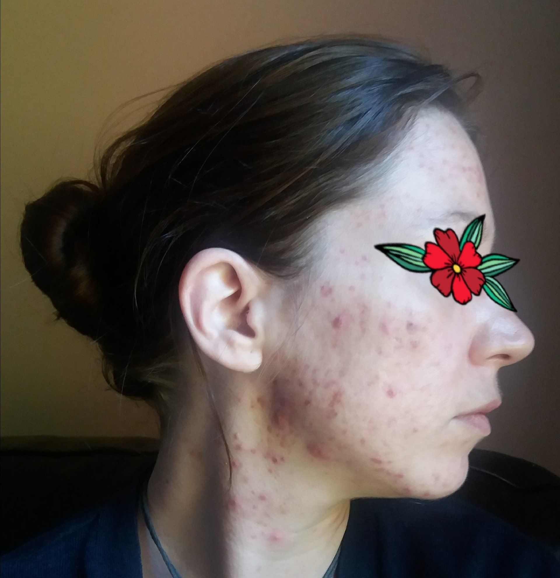 right side of face improving