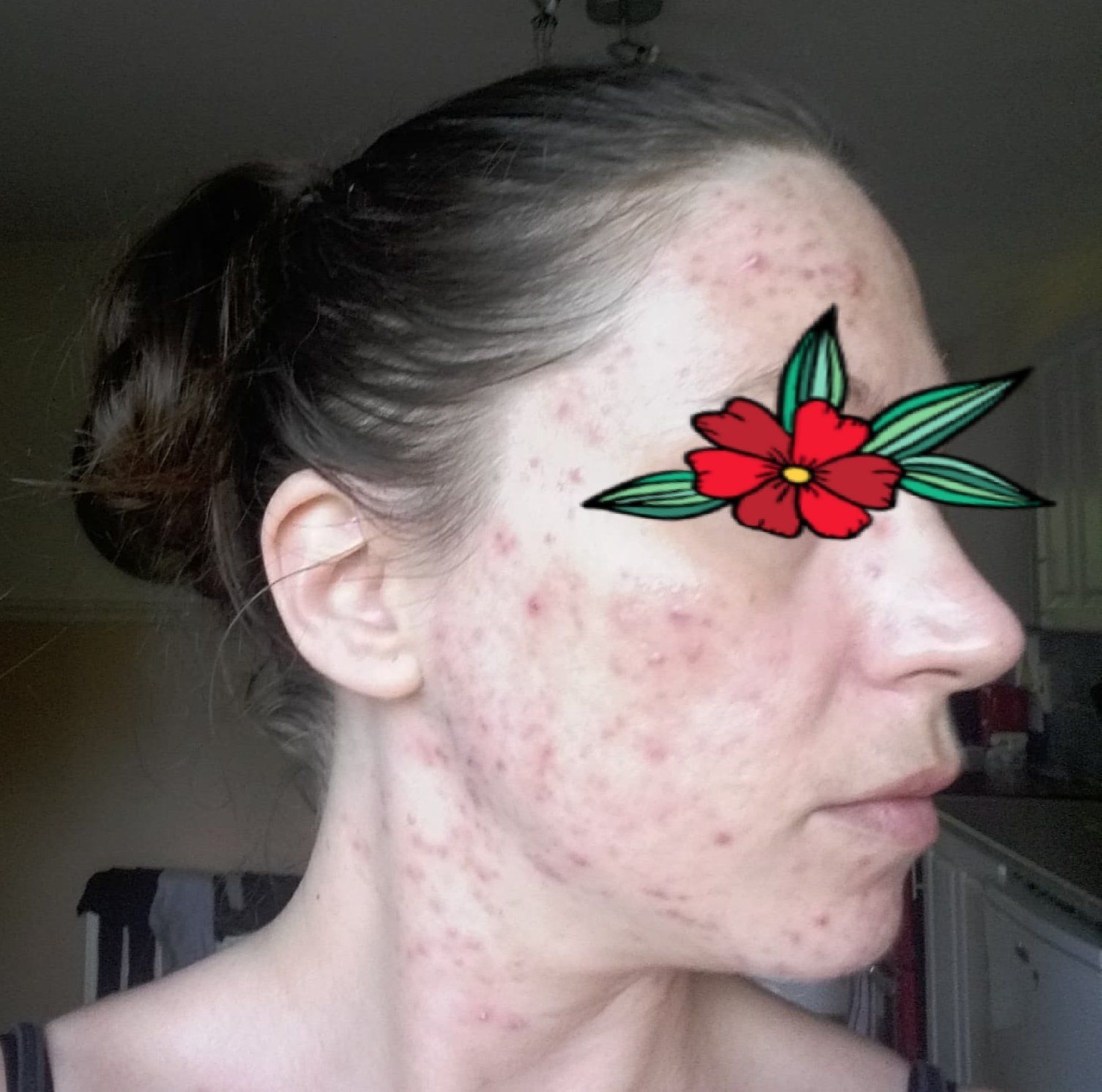 right side of face improvement