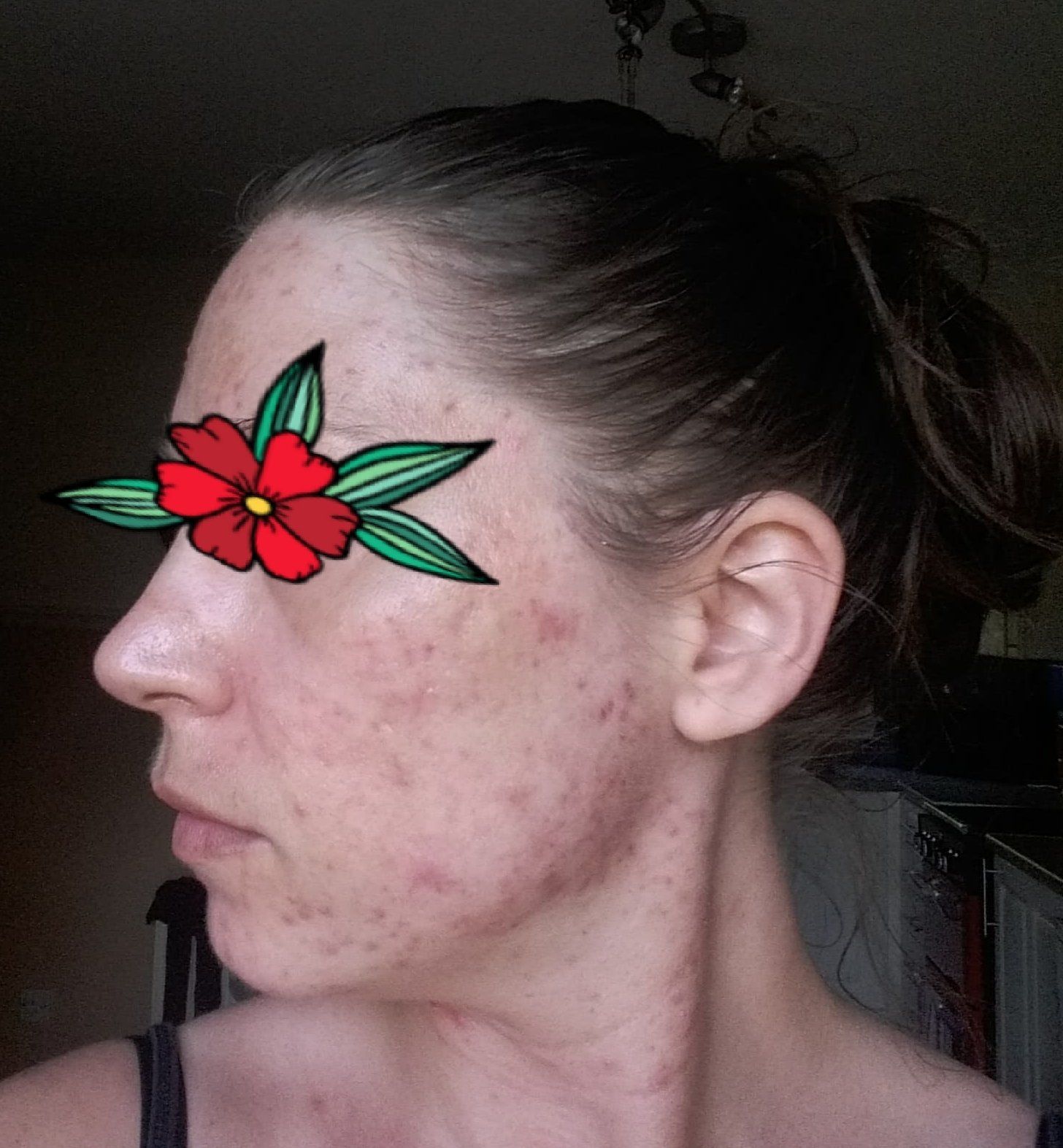 left side of face improvement