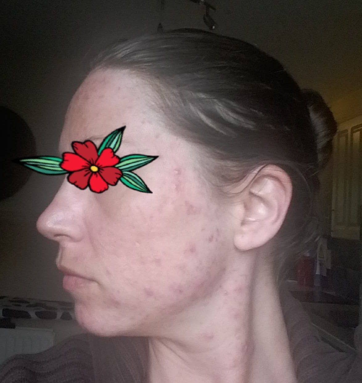 right side of face