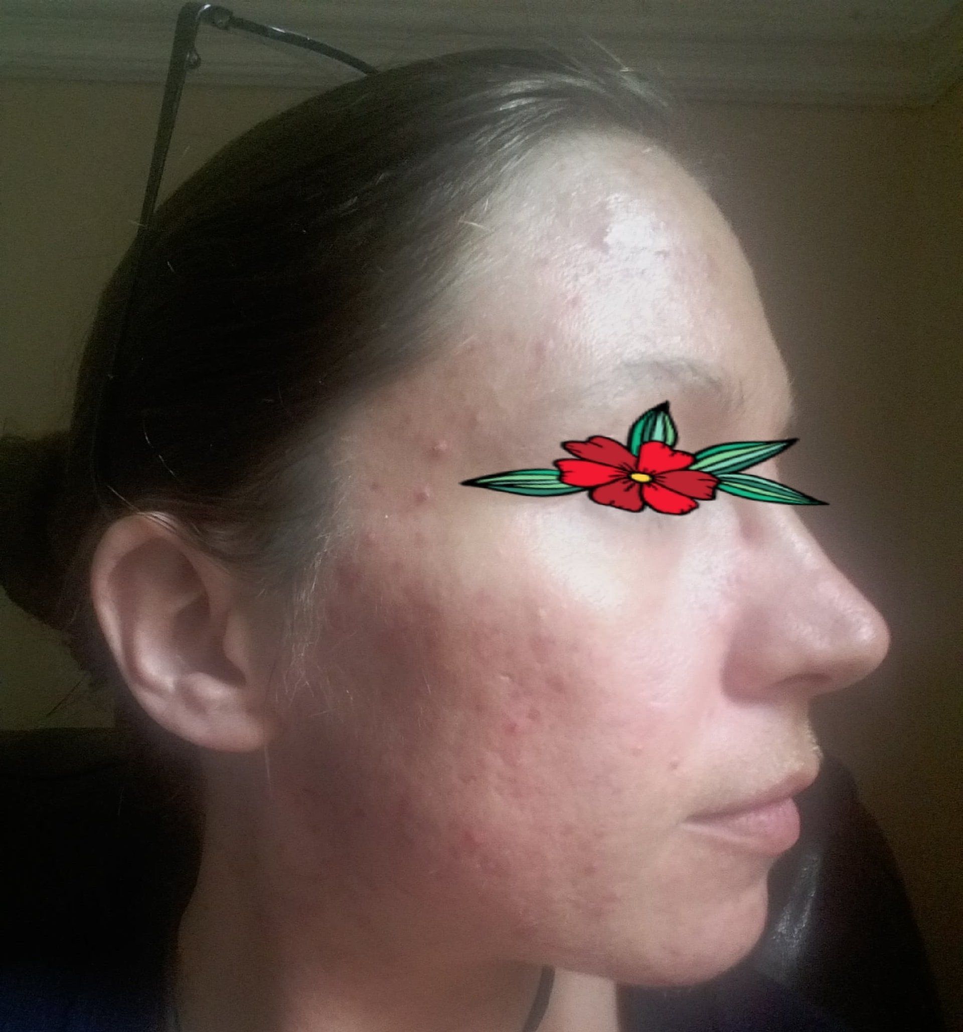 right side of face
