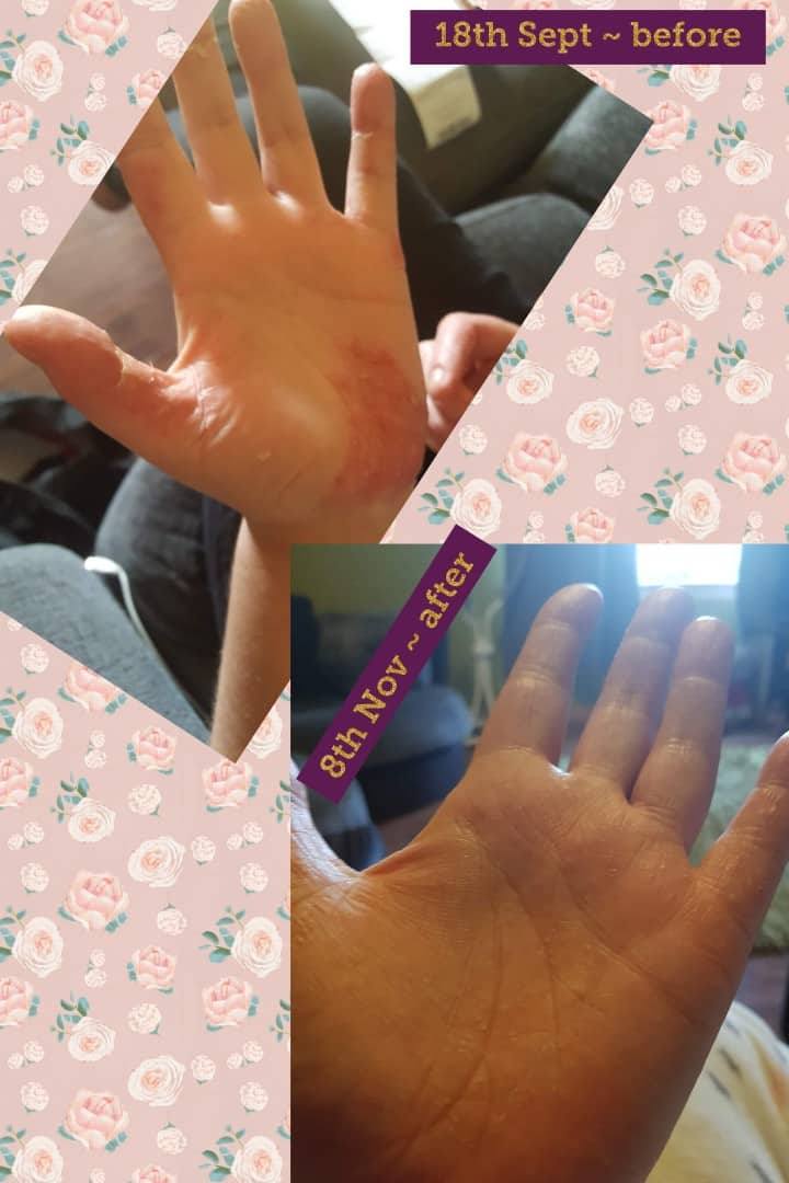 open palm pictures from success story