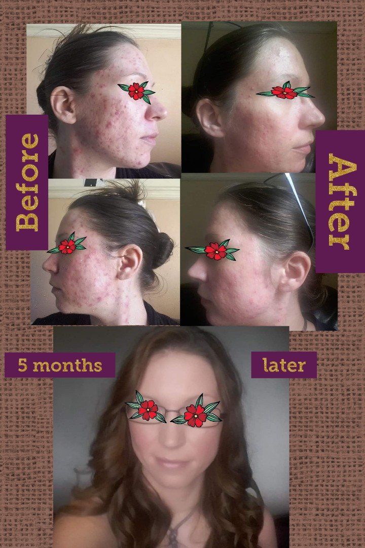 collage of before and after photos of Jenny