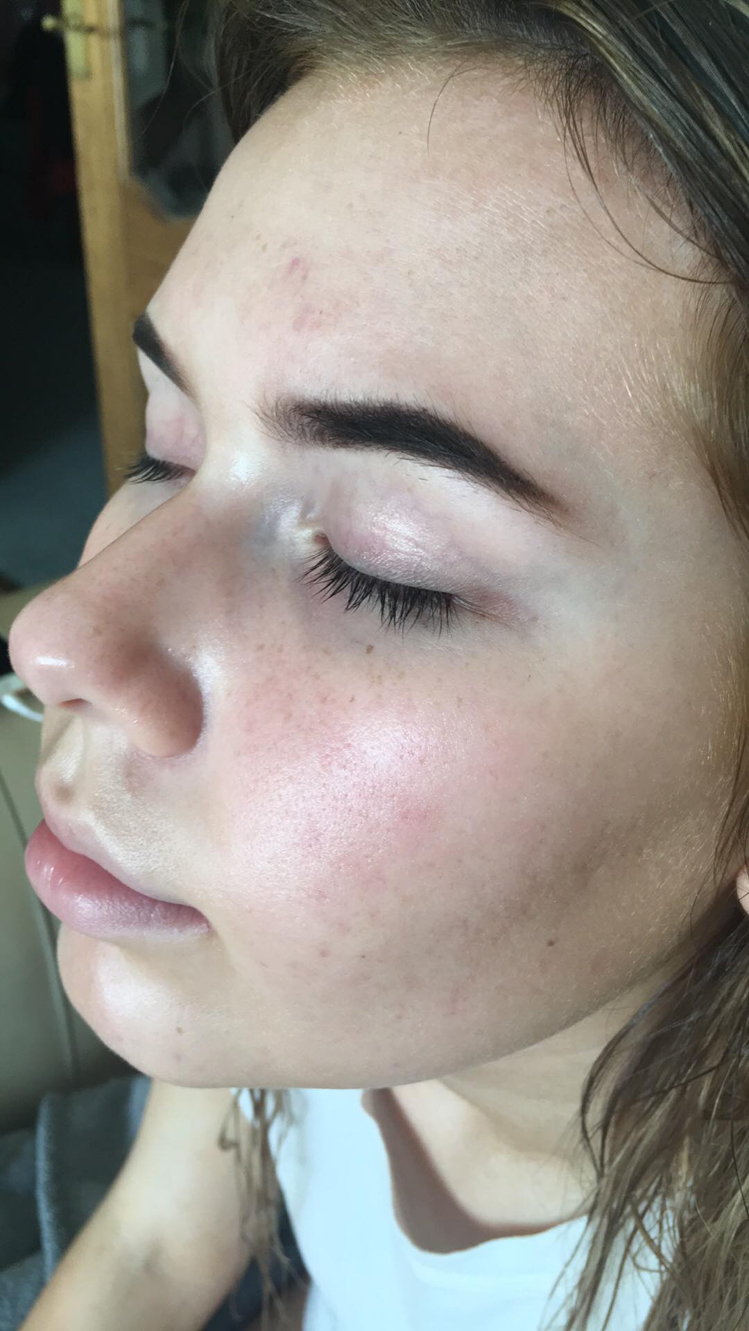 Debbie McLeod after 13 days