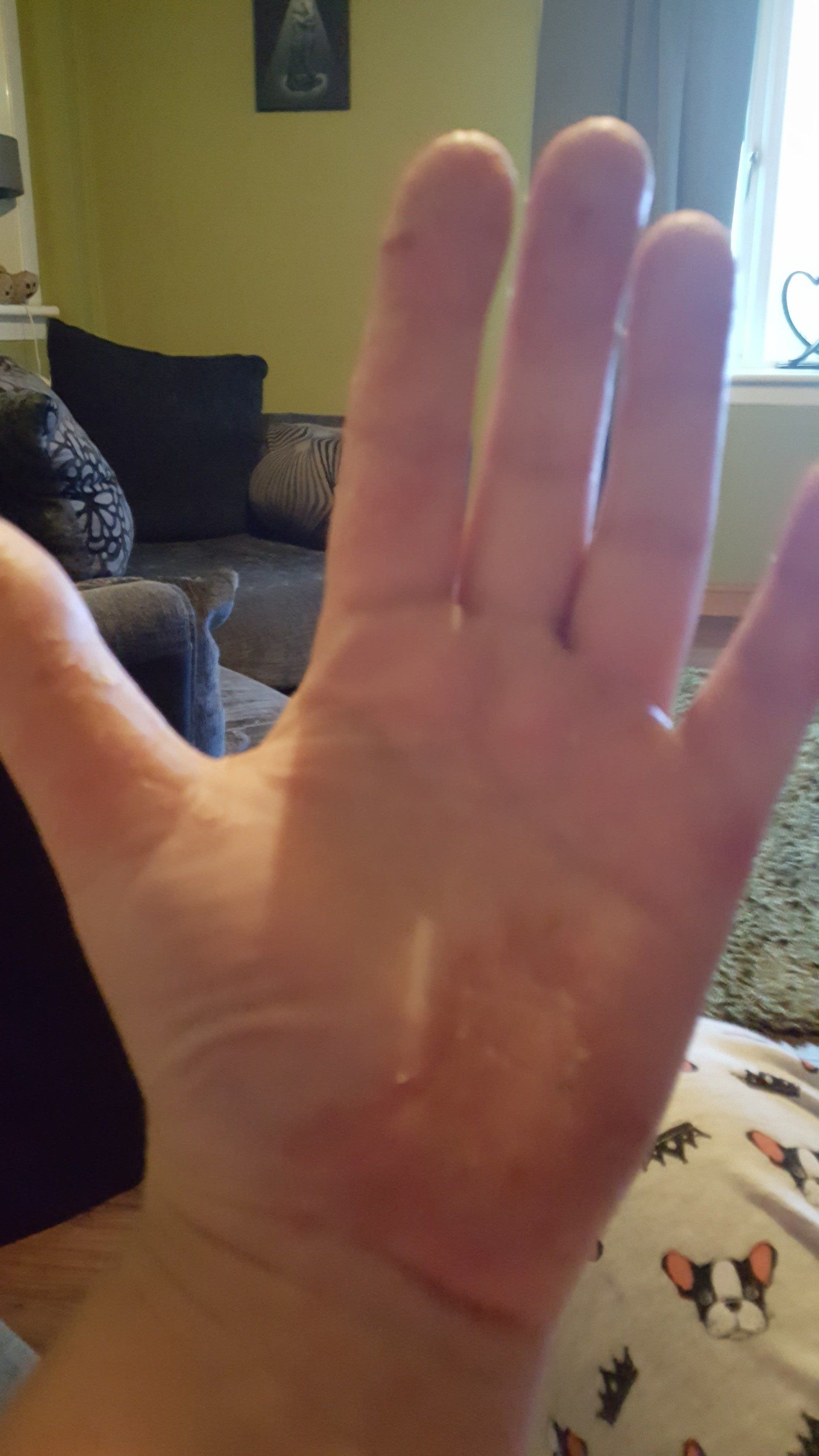 Day 5 open left palm