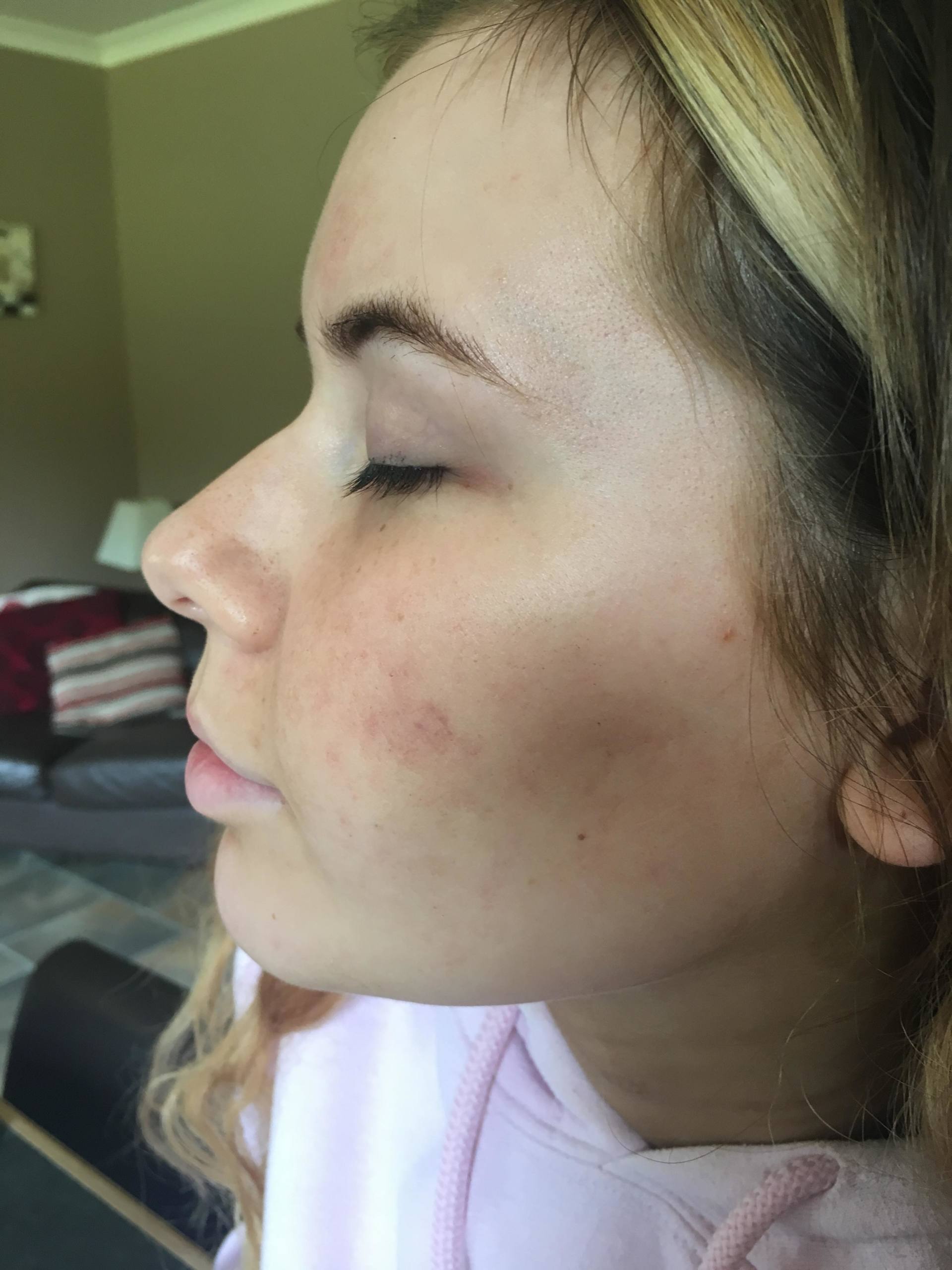 Debbie Mcleod after 1 day