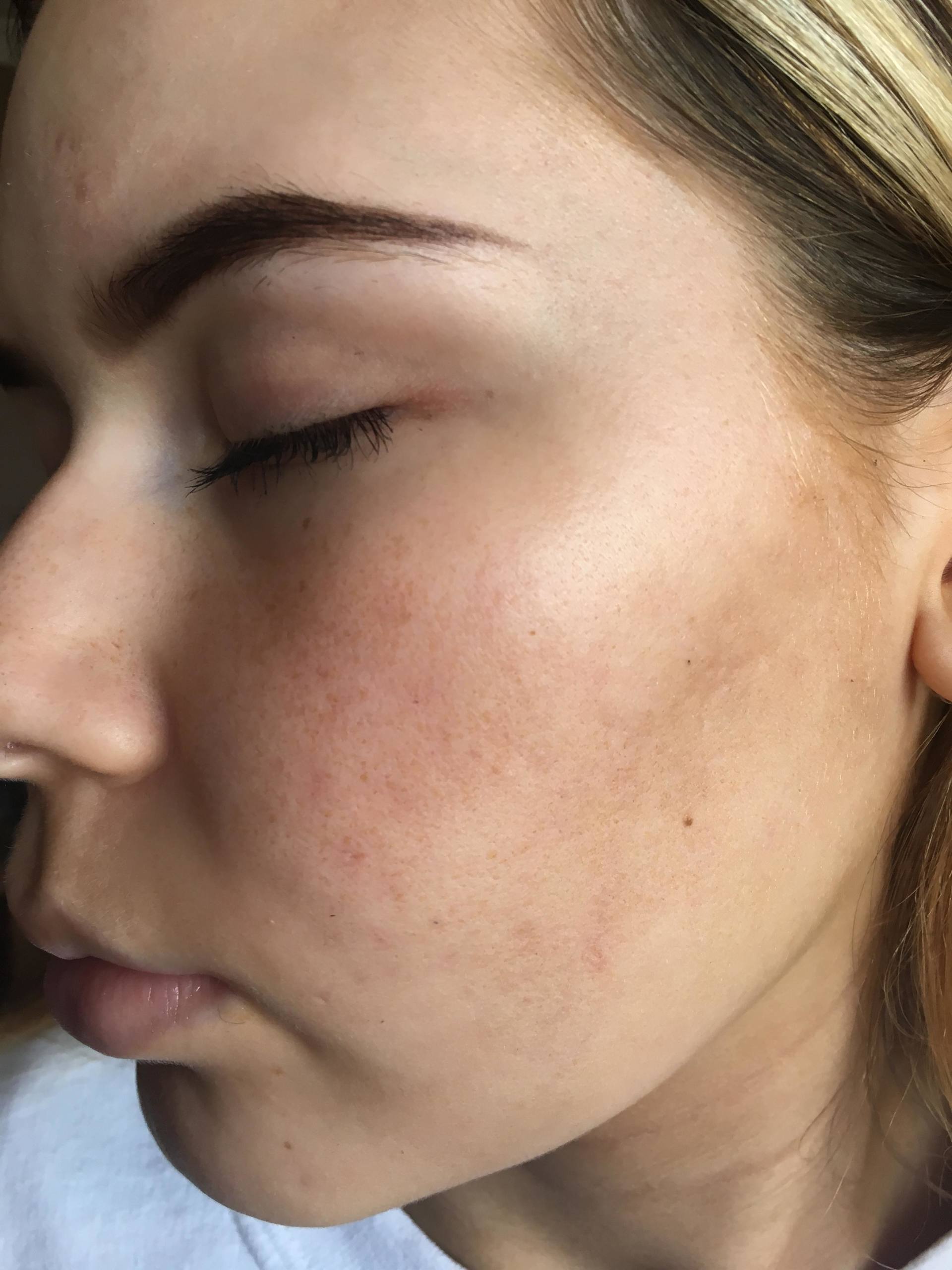 Debbie McLeod after 5 or 6 days