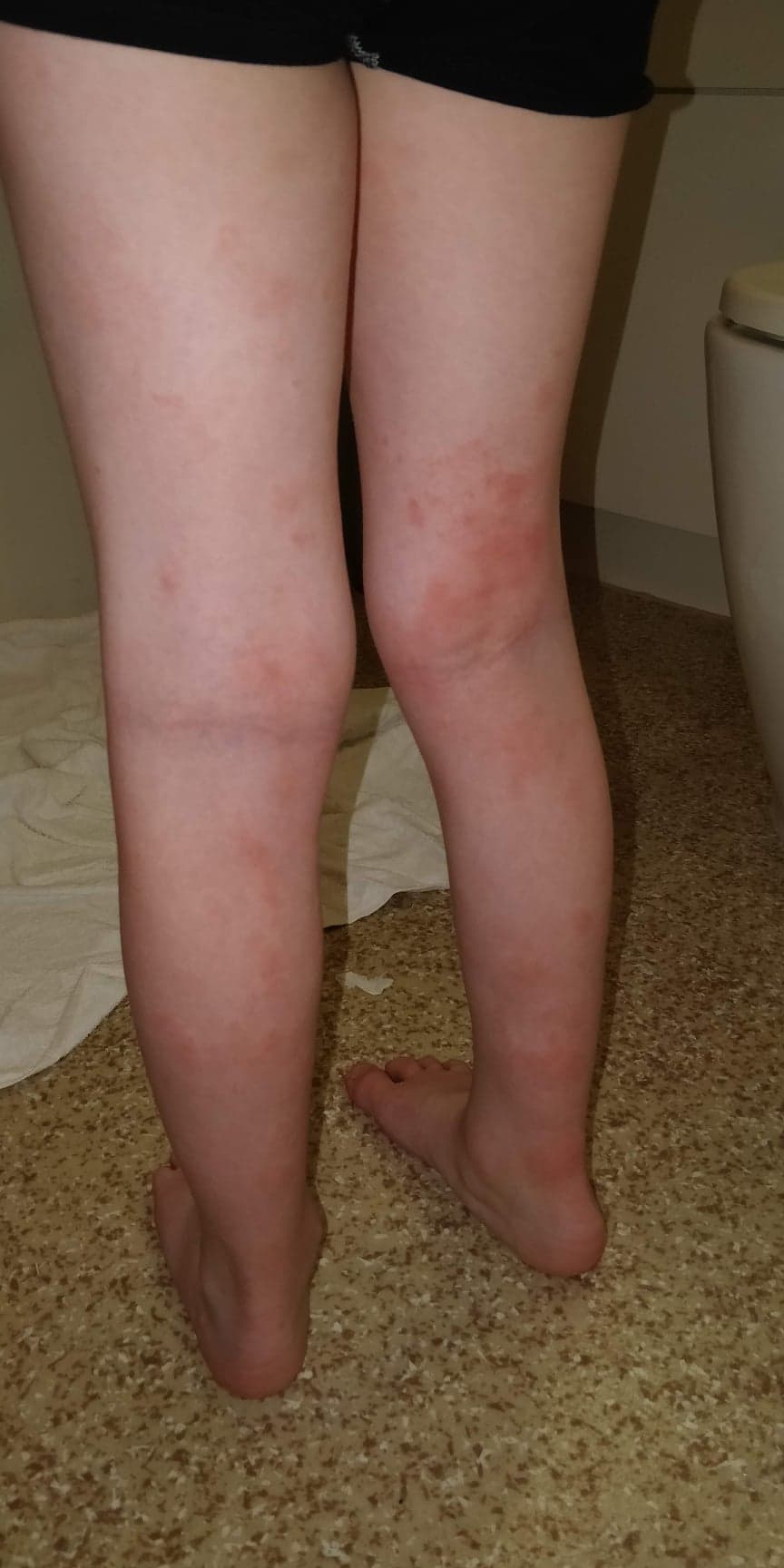 baby's legs from behind next morning