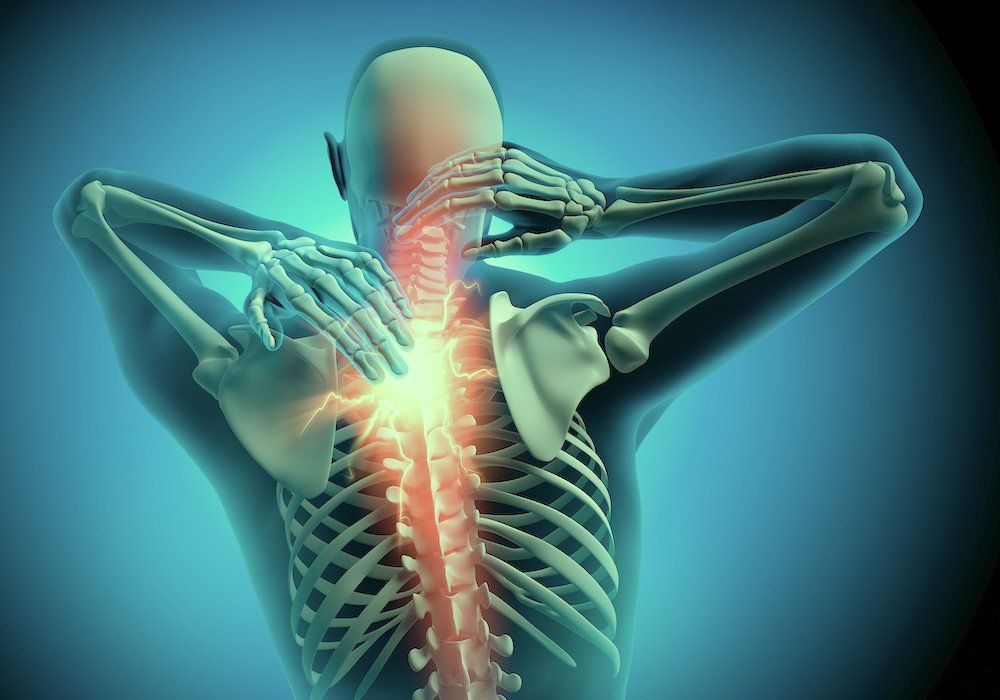 Nackenschmerzen Nackenschmerzen