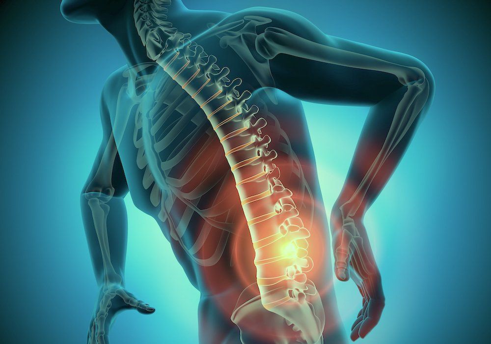 Rückenschmerzen Rückenschmerzen