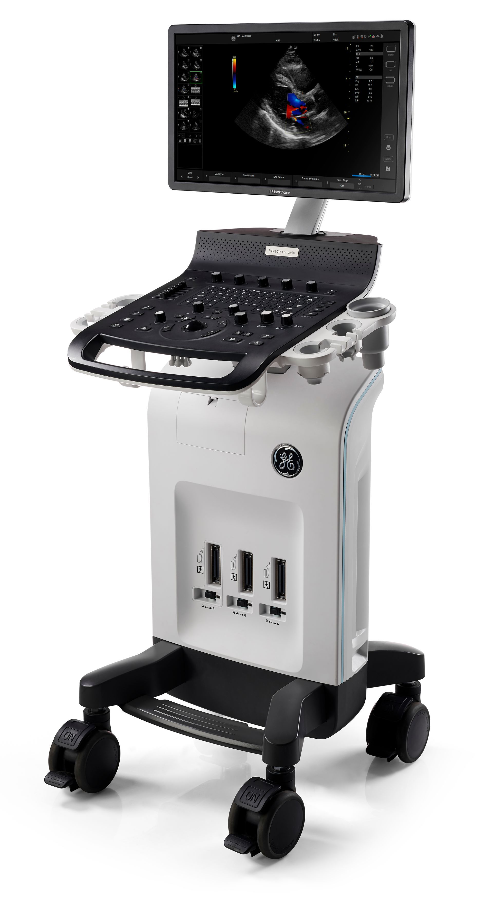 GE Versana Essential GE Versana Essential