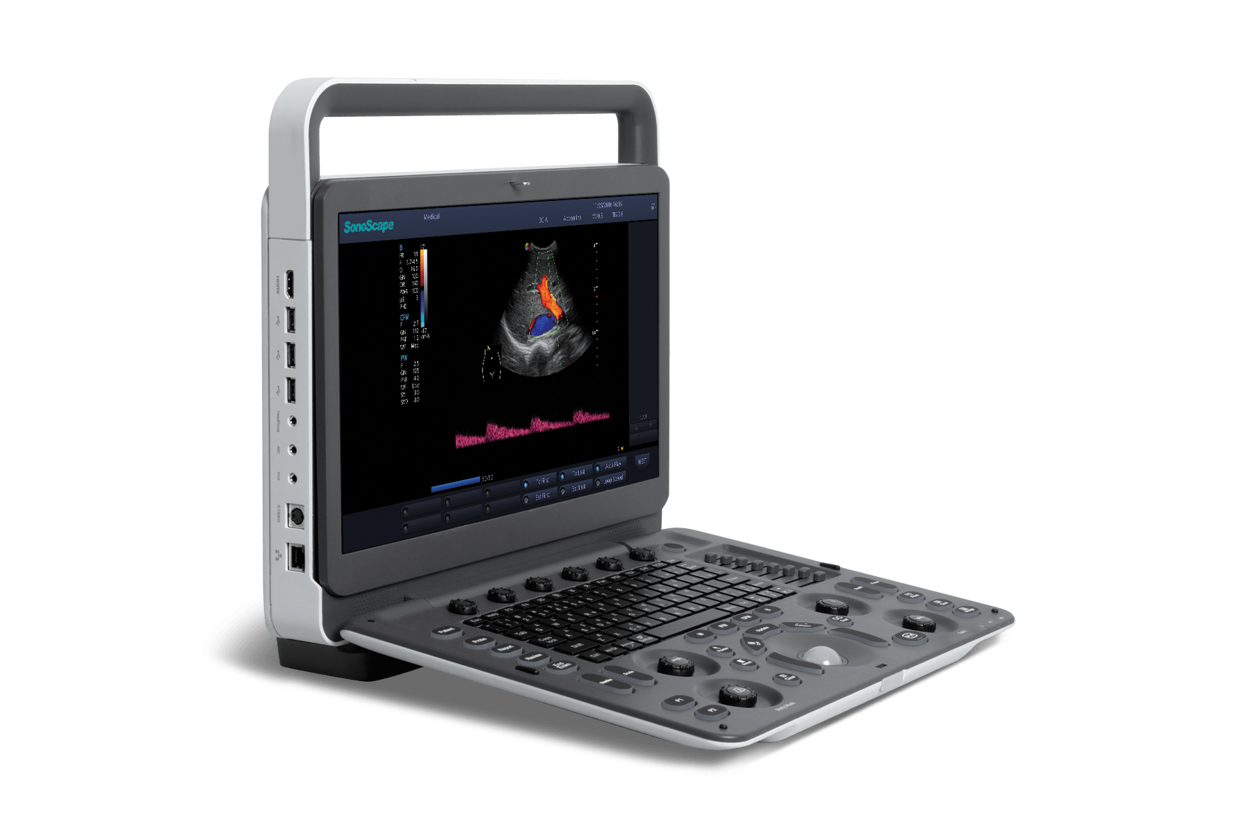 SonoScape E2 - günstiges Ultraschallgerät mit Farbdoppler