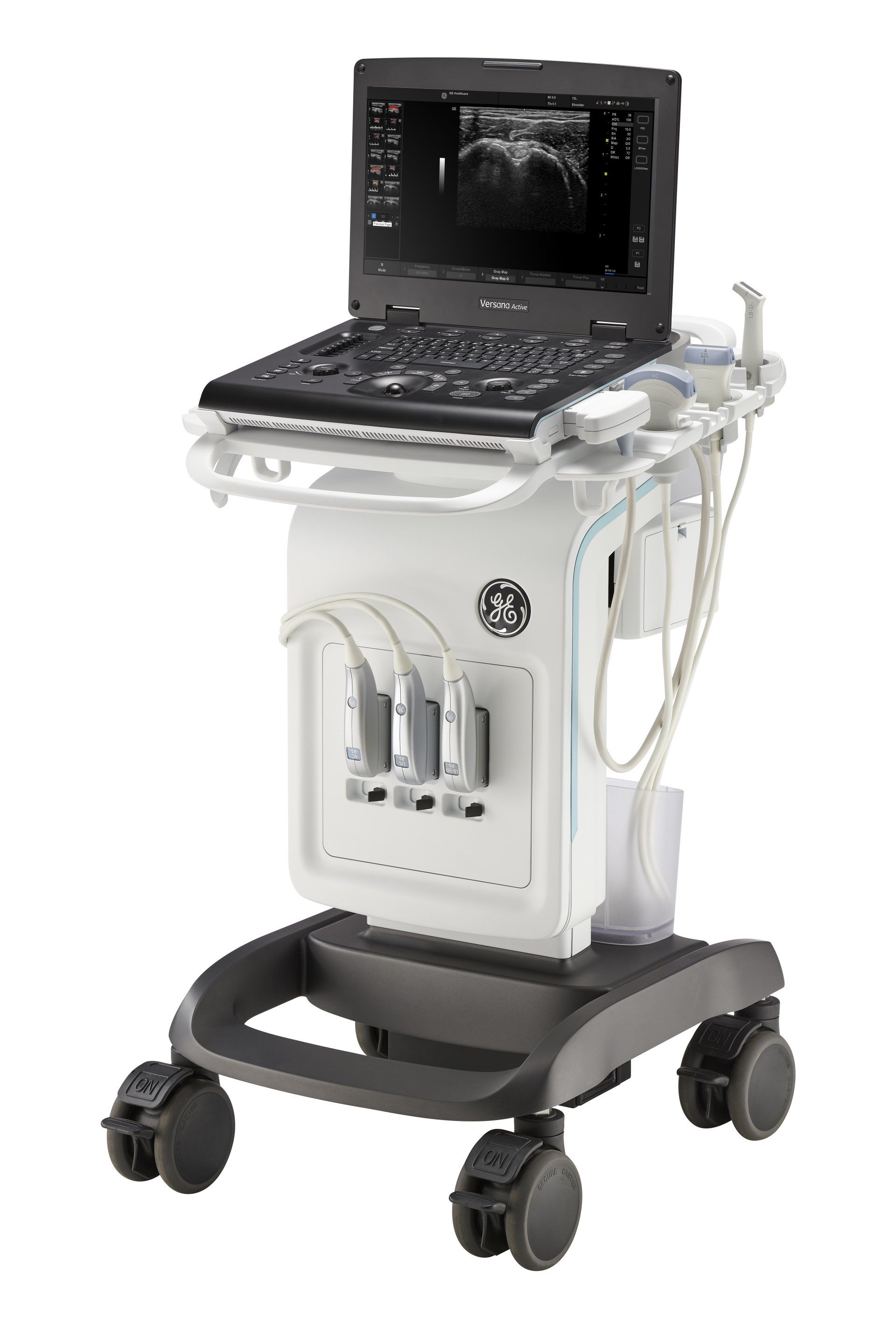 Ultraschallgerät GE Versana Active