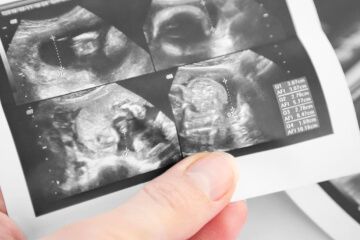 Ultraschallbilder Digitalisieren