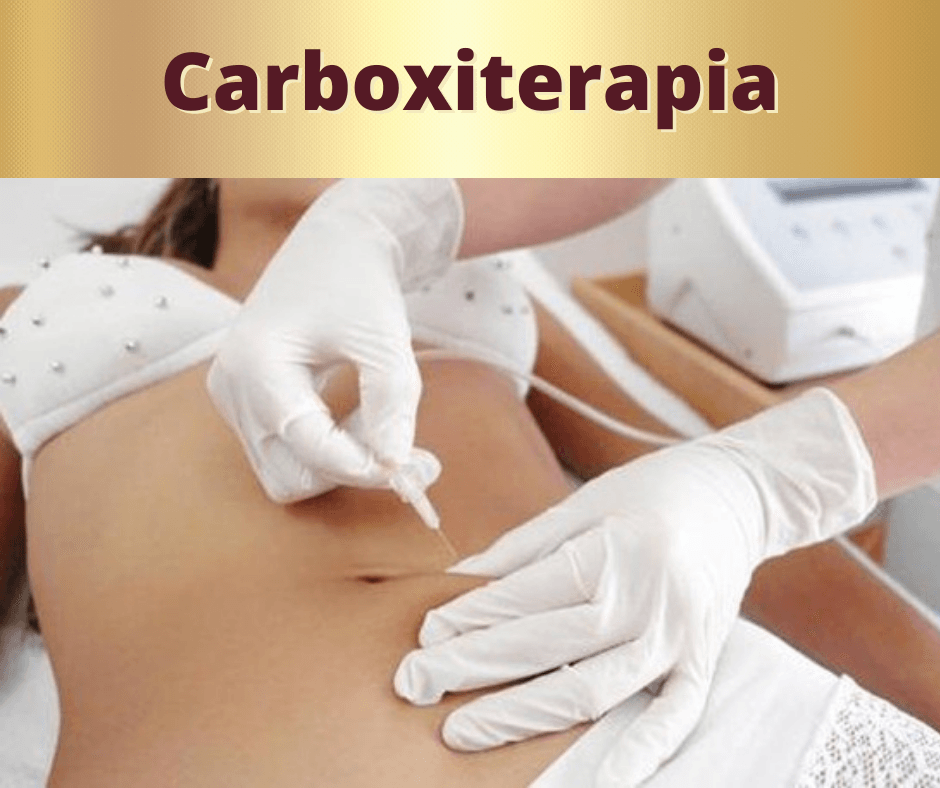 Carboxiterapia