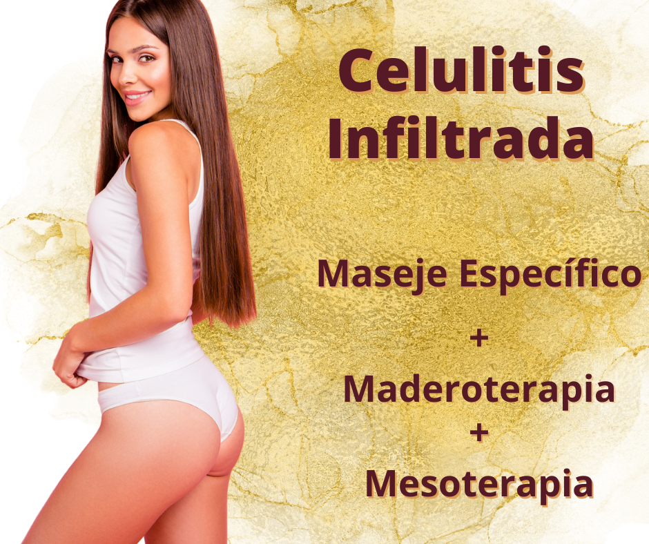 Celulitis
