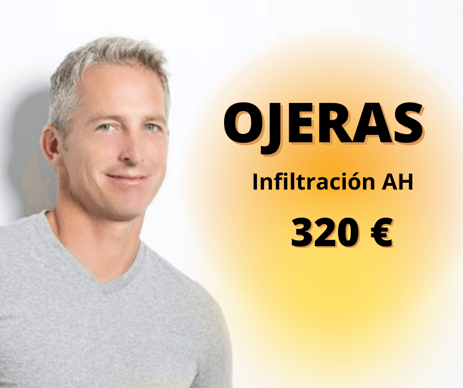 OJERAS
