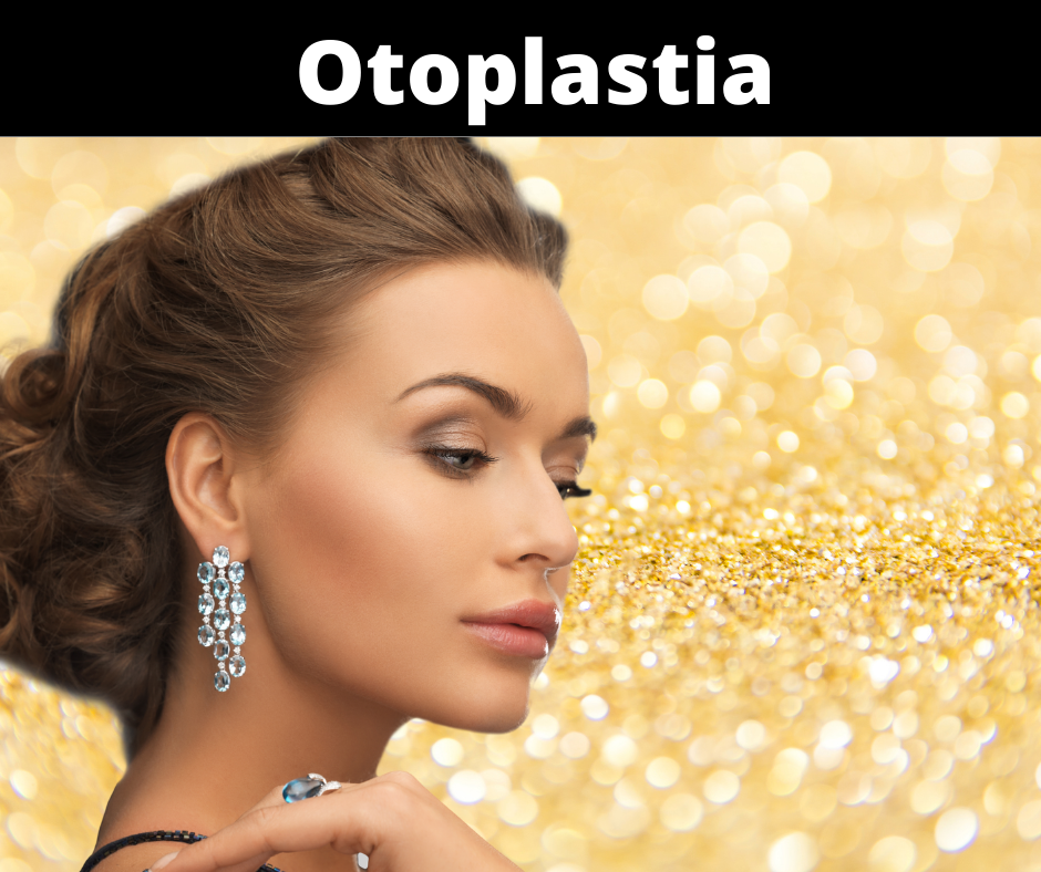 Otoplastia