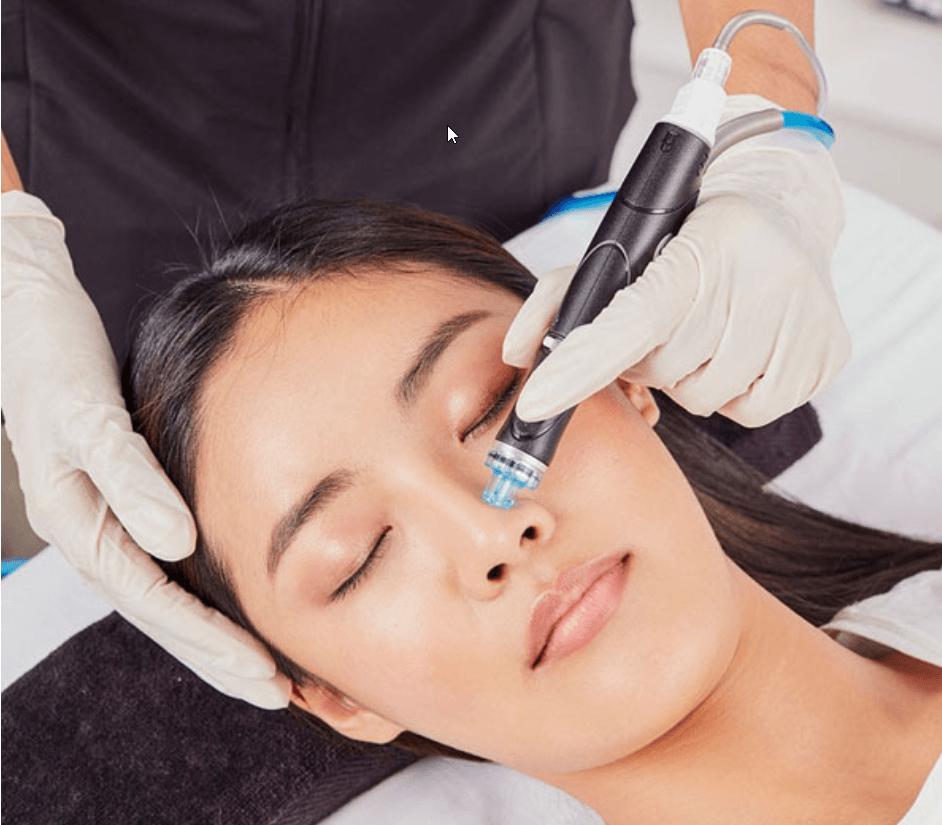 Nur bei Kosmetik Saranda Hydrafacial Hydrafacial in Neckagemünd
