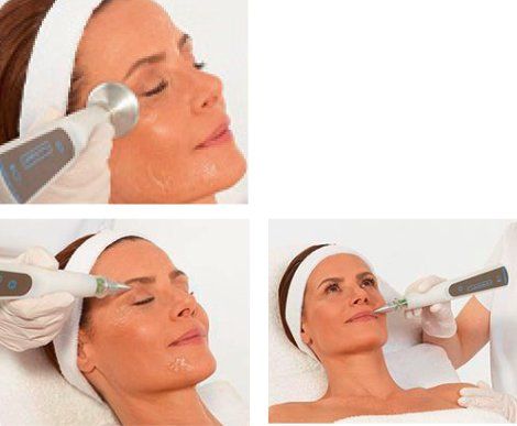 Plasmastreaming Plasmastreaming