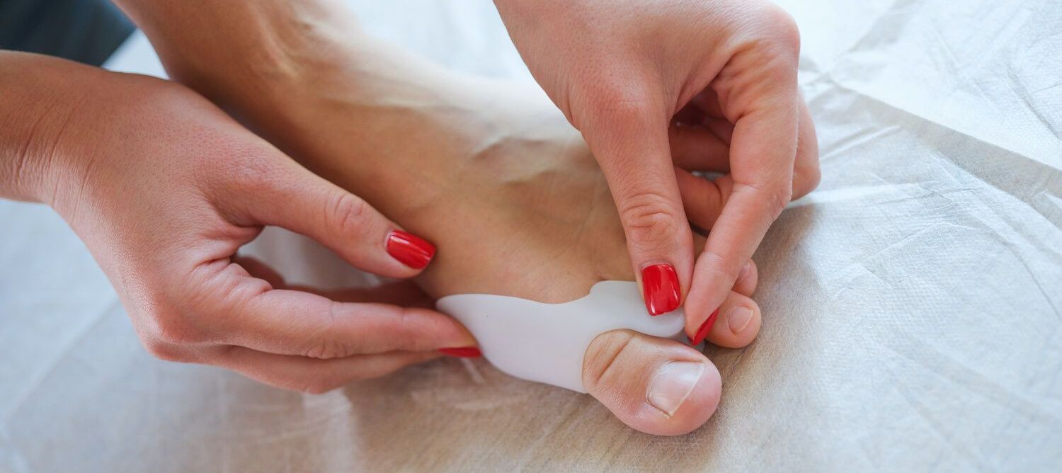 Foto von einem Silikonschutz, der an einer großen Fußzeh angebracht wird Foto von einem Silikonschutz, der an einer großen Fußzeh angebracht wird