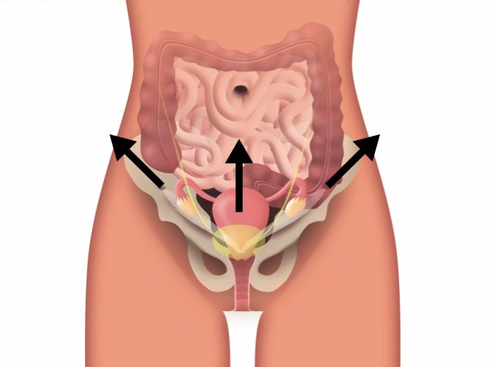 Prolasso Emorroidario