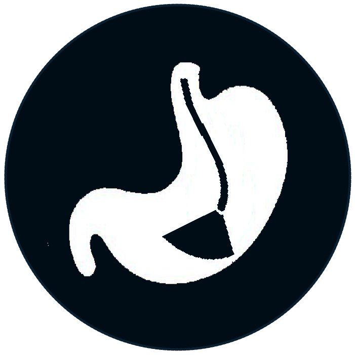 gastroscopia