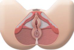 chirurgia pavimento pelvico
