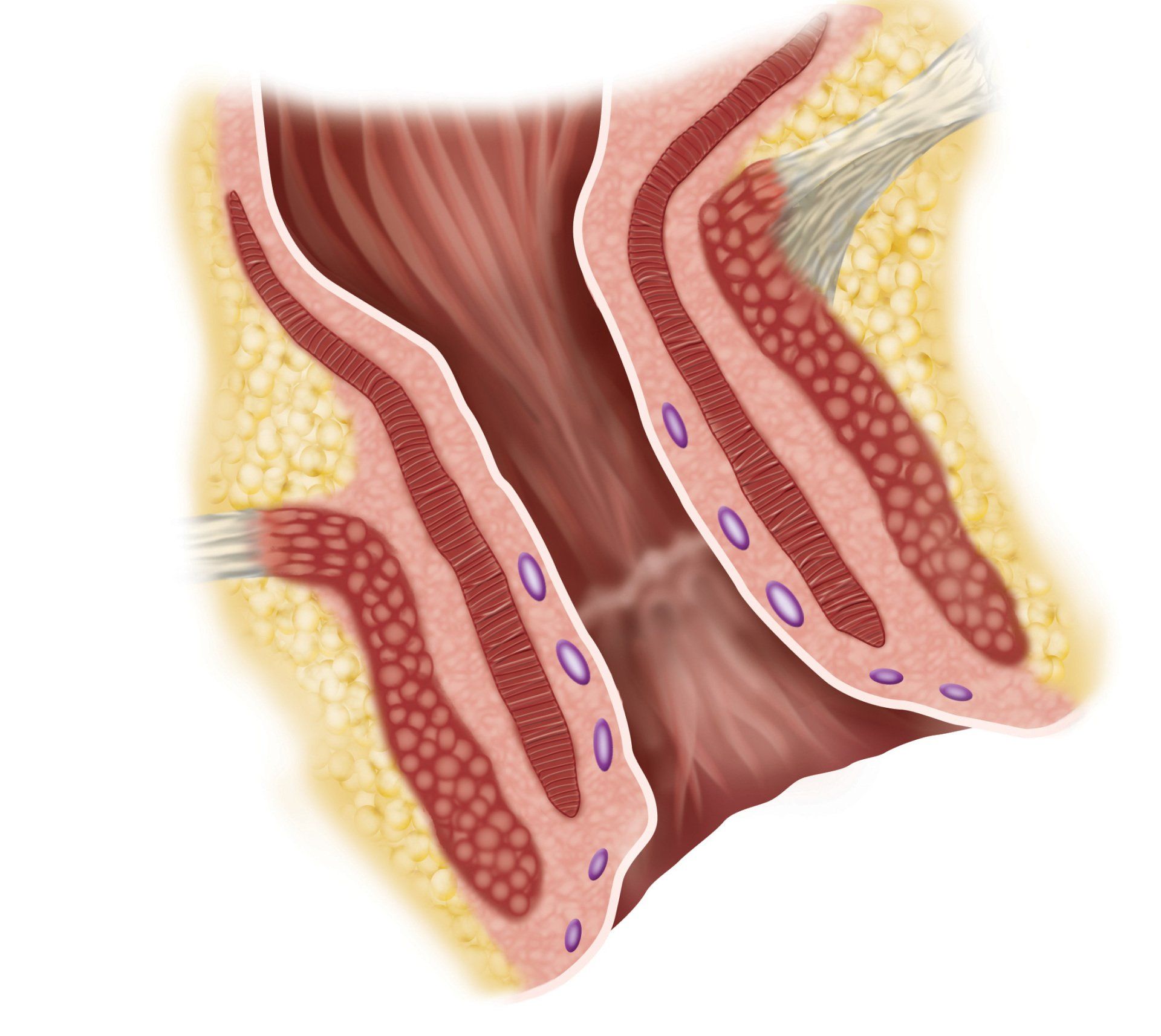 Incontinenza fecale, sfintere anale, perdita feci, perdita gas