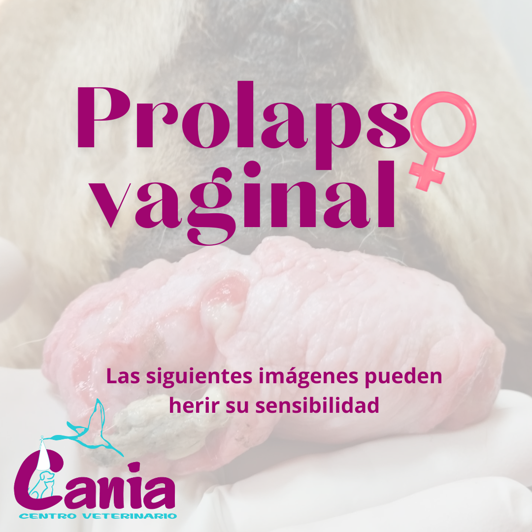 PROLAPSO VAGINAL
El prolapso vaginal es una “masa” que sobresale de la vulva. Se trata de un exteriorización de la mucosa vaginal (tejido que conforma la vagina), la cual aumenta de tamaño por acción de las hormonas del celo (estrógenos). Es por ello que suele producirse en esta etapa, si bien puede ocurrir también durante el embarazo limitando la posibilidad de parto natural. Una vez ocurra, suele repetirse en los siguientes celos entre el 65-100% de los casos.
Es un proceso marcado genéticamente, por lo que suele repetirse en hijas, nietas, etc, existiendo predisposición en determinadas razas (Pej. Braquicefálicas como Bulldog, Carlino, Boxer, pero también en otras razas como Gran Danés y Labradores...).
Dependiendo de la cantidad de tejido exteriorizado se clasifican en tres estadios (grado I, II o III). El diagnóstico pasa por la valoración del veterinario, donde dependiendo de la forma de prolapso, momento en el que ocurre y pruebas diagnósticas (citología vaginal), podrá establecer si se trata de una hiperplasia/prolapso vaginal o un tumor.
El tratamiento dependerá del estado del tejido prolapsado y del valor reproductivo del animal, porque al quitar la fuente de hormonas del celo (esterilización /ovariohisterectomía), el tejido muchas veces es capaz de “recogerse” sin necesidad propiamente de extirparlo. En otros casos (grado III, tejido dañado, exposición prolongada tras haber acabado el celo) es necesario retirar también el tejido vaginal en la misma cirugía. En cualquier caso, siempre se debe esterilizar para evitar que en futuros celos el problema se repita. Asimismo, mientras tanto el tejido vaginal debe ser tratado para evitar se dañe.
Las complicaciones asociadas al prolapso suelen ser problemas al orinar, infecciones de orina, necrosis (muerte) del tejido vaginal, sangrado, dolor, y en casos extremos sepsis generalizada por expansión de infección.
Caso clínico:
Paciente Carlina de 11 años que acude remitida de otro Centro Veterinario para valoración y programación de cirugía por prolapso vaginal.
En el último celo (hacía 2.5 meses) la paciente exteriorizó una gran masa a nivel vulvar que no se “recogió” a pesar de terminar el celo. También padecía una infección de orina a causa de ésta, de la que estaba siendo tratada.
Tras la valoración prequirúrgica con apto para la cirugía, la paciente es sometida a intervención quirúrgica donde se realiza ovariohisterectomía y extirpación de la masa vaginal.