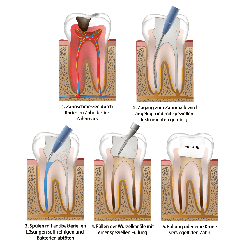 Endodontologie