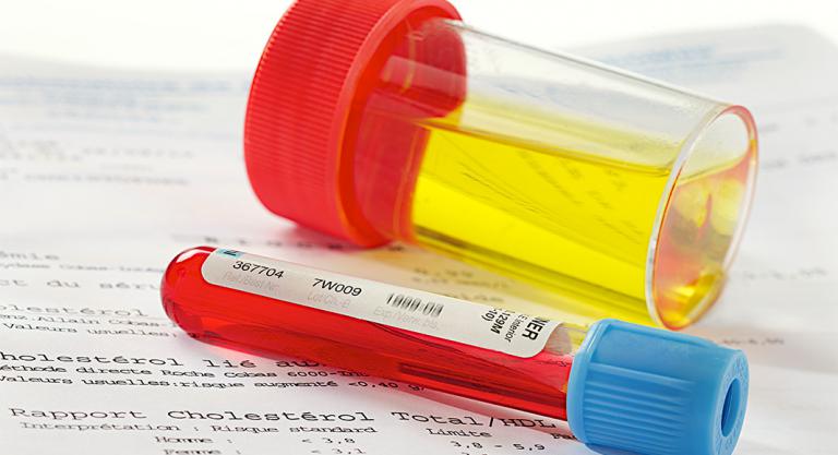 Analítica de sangre y de orina Analítica de sangre y de orina