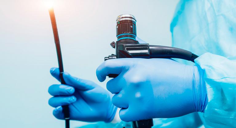 Examen colorrectal como prevención del cáncer de colon Examen colorrectal como prevención del cáncer de colon