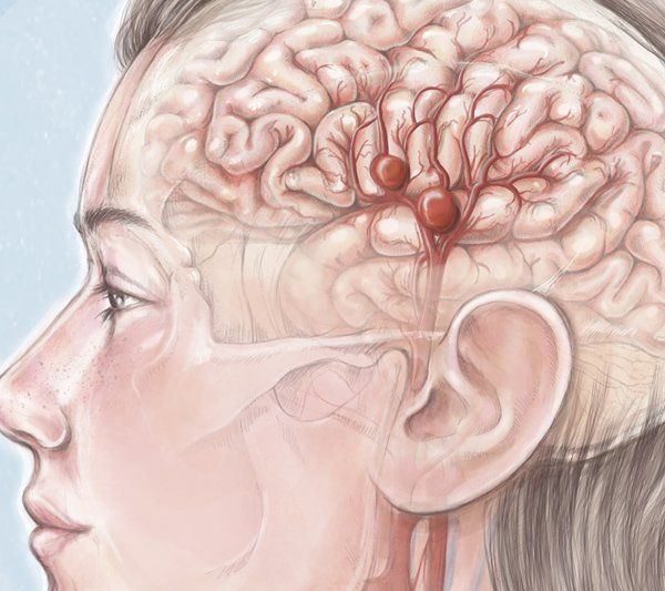 Texto para los buscadores