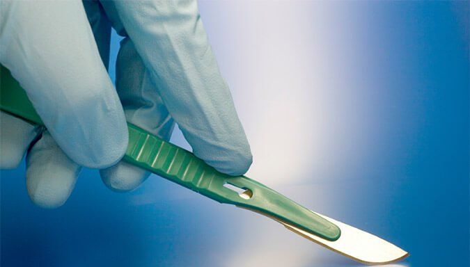 Ilustración del procedimiento quirúrgico para corregir una hernia lumbar