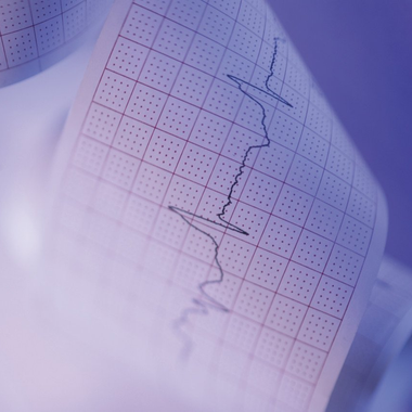EKG, Rhythmus, Puls, Langzeit-EKG, Herz, Kardiologie, 24-Stunden-EKG