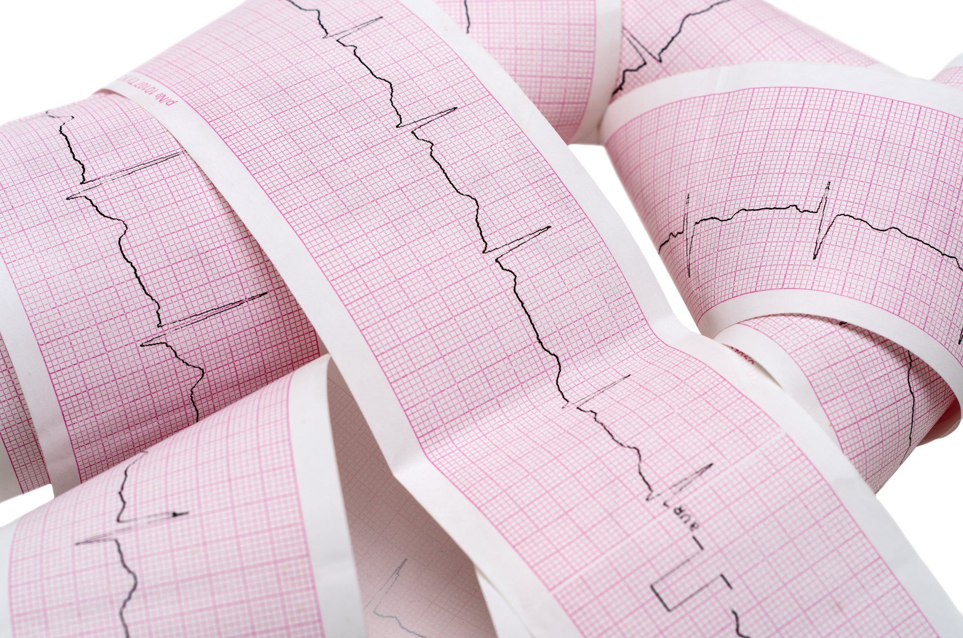 Herzrhytmus, Puls, Vorhofflimmern, langsam, schnell, Sinusrythmus, Pause, Schrittmacher, EKG